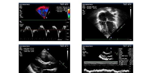 Laudo Ecocardiograma Fetal-imagens-0002